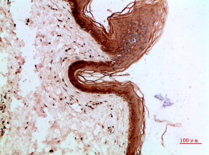 Fig.2. Immunohistochemical analysis of paraffin-embedded human-skin, antibody was diluted at 1:200.