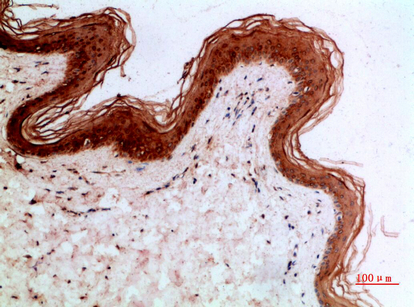 Fig.3. Immunohistochemical analysis of paraffin-embedded human-skin, antibody was diluted at 1:200.