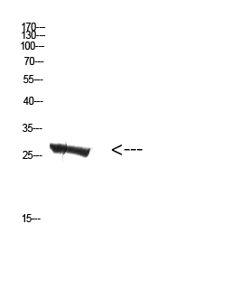 Fig.1. Western Blot analysis of Mouse-kidney cells using Antibody diluted at 1:500. Secondary antibody (catalog#: A21020) was diluted at 1:20000.
