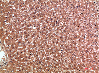 Fig.2. Immunohistochemical analysis of paraffin-embedded human-liver, antibody was diluted at 1:200.