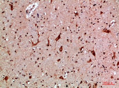 Fig.4. Immunohistochemical analysis of paraffin-embedded human-brain, antibody was diluted at 1:200.