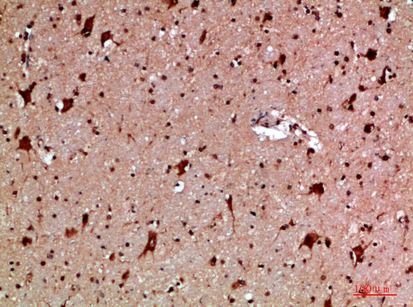 Fig.5. Immunohistochemical analysis of paraffin-embedded human-brain, antibody was diluted at 1:200.