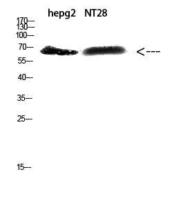 Fig. Western Blot analysis of hepg2,  NT28 cells using Antibody diluted at 1:500. Secondary antibody (catalog#: A21020) was diluted at 1:20000.
