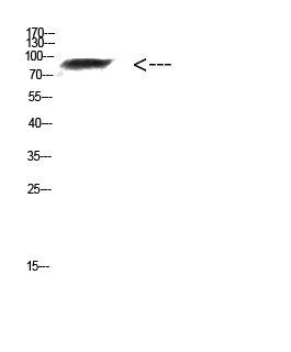 Fig. Western Blot analysis of Mouse-kidney cells using Antibody diluted at 1:1000. Secondary antibody (catalog#: A21020) was diluted at 1:20000.