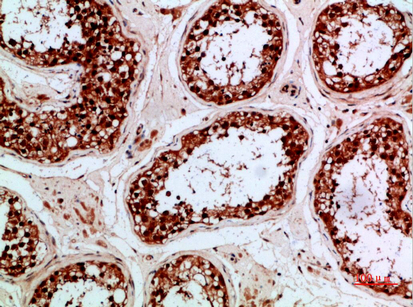 Fig.2. Immunohistochemical analysis of paraffin-embedded human-testis, antibody was diluted at 1:200.