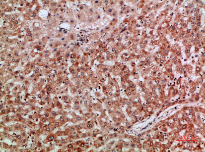 Fig.4. Immunohistochemical analysis of paraffin-embedded human-liver, antibody was diluted at 1:200.