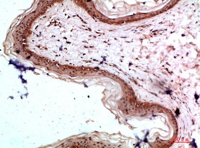 Fig.2. Immunohistochemical analysis of paraffin-embedded human-skin, antibody was diluted at 1:200.