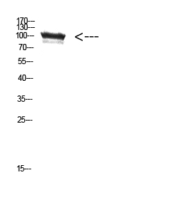 Fig. Western Blot analysis of HEPG2 cells using Antibody diluted at 1:500. Secondary antibody (catalog#: A21020) was diluted at 1:20000.