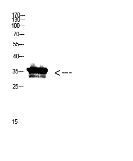 Fig. Western Blot analysis of KB cells using Antibody diluted at 1:500. Secondary antibody (catalog#: A21020) was diluted at 1:20000.