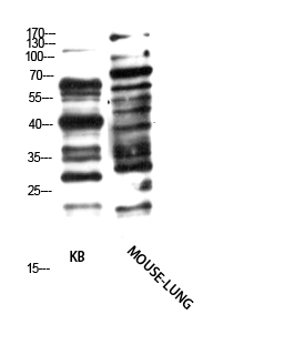 Fig. Western Blot analysis of KB, Mouse-LUNG cells using Antibody diluted at 1:1000. Secondary antibody (catalog#: A21020) was diluted at 1:20000.