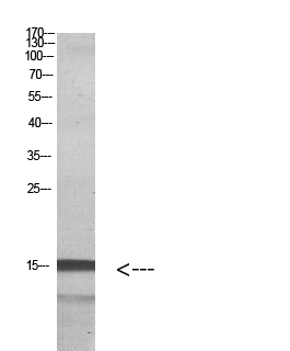 Fig. Western blot analysis of HELA Cell Lysate using antibody. Secondary antibody (catalog#: A21020) was diluted at 1:20000.