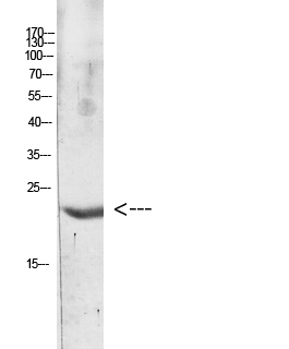 Fig.1. Western blot analysis of Hela Cell Lysate using antibody. Secondary antibody (catalog#: A21020) was diluted at 1:20000.