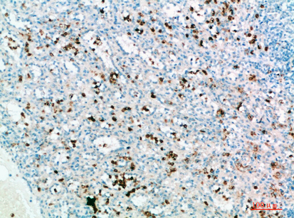 Fig.4. Immunohistochemical analysis of paraffin-embedded human-spleen, antibody was diluted at 1:200.