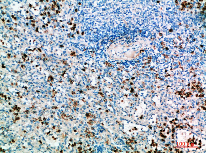 Fig.5. Immunohistochemical analysis of paraffin-embedded human-spleen, antibody was diluted at 1:200.