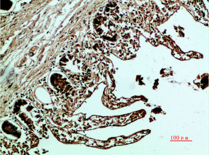 Fig.1. Immunohistochemical analysis of paraffin-embedded human-colon, antibody was diluted at 1:200.