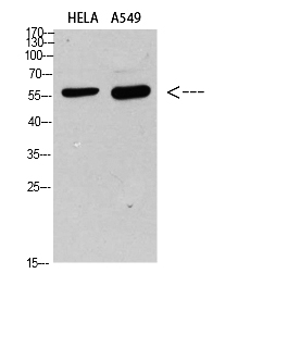 Fig. Western blot analysis of HELA A549 Cell Lysate, antibody was diluted at 1:1000. Secondary antibody (catalog#: A21020) was diluted at 1:20000.