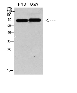 Fig.1. Western blot analysis of HELA A549 Cell Lysate, antibody was diluted at 1:1000. Secondary antibody (catalog#: A21020) was diluted at 1:20000.