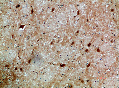 Fig.2. Immunohistochemical analysis of paraffin-embedded human-brain, antibody was diluted at 1:200.