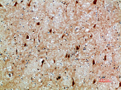 Fig.3. Immunohistochemical analysis of paraffin-embedded human-brain, antibody was diluted at 1:200.