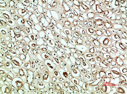 Fig. Immunohistochemical analysis of paraffin-embedded human-kidney, antibody was diluted at 1:200.