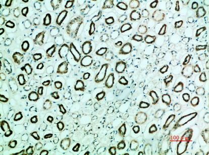 Fig.3. Immunohistochemical analysis of paraffin-embedded human-kidney, antibody was diluted at 1:200.