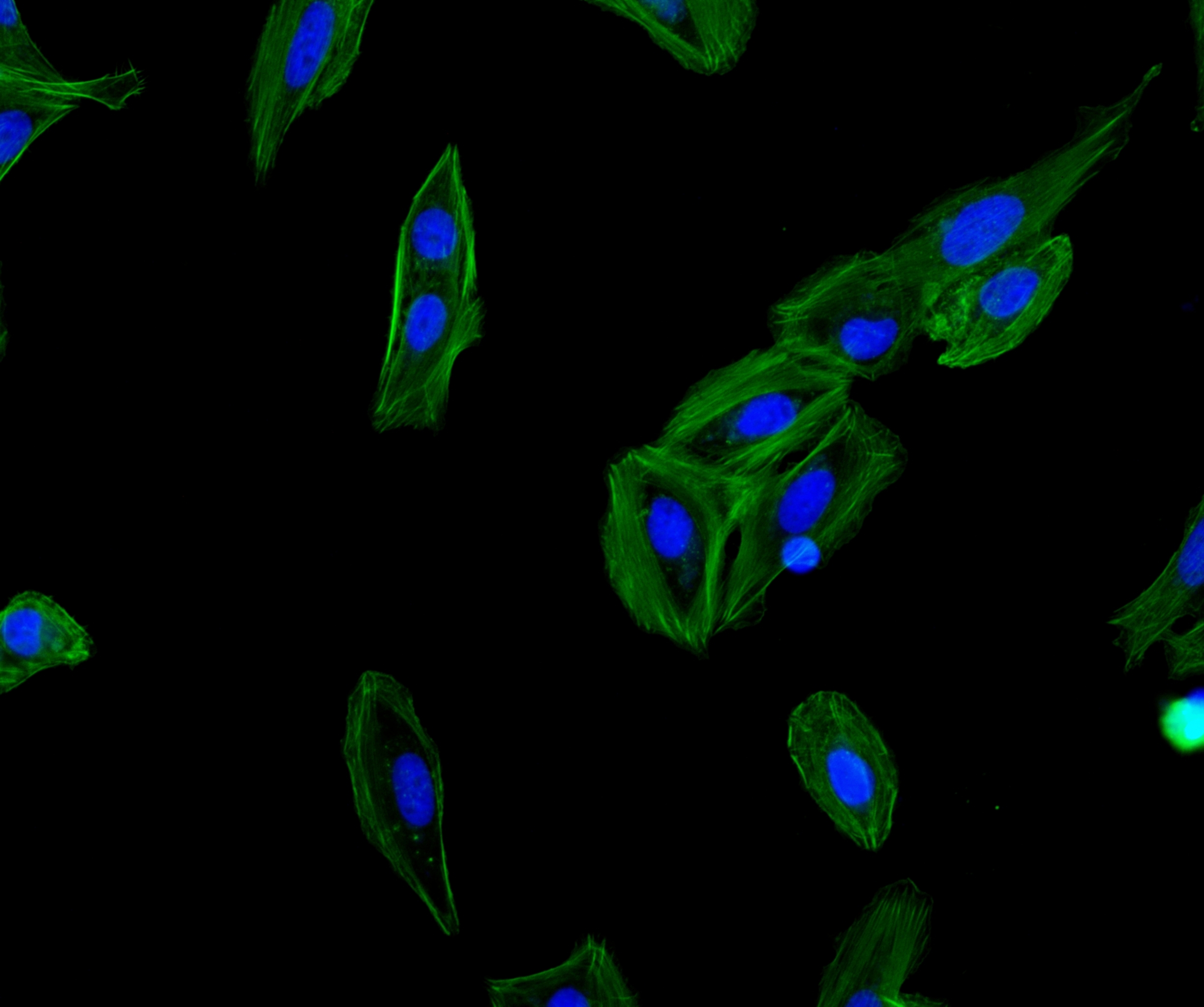 Fig. AbFluor™ 488-Phalloidin in Hela cells (200×)