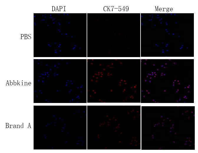 Fig.1.IF result comparison between BMP4010 and other brand shows Abbkine Universal Antibody Diluent Buffer detects a more obvious signal.