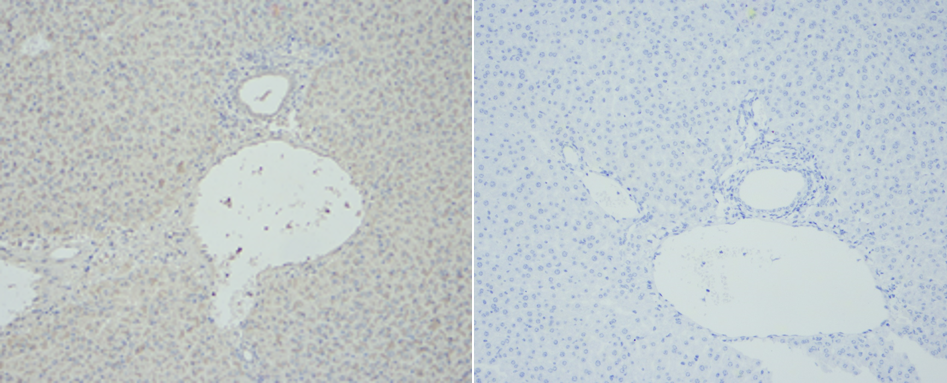 Fig.2. 左图：SuperKine™ 增强型稀释液IHC验证的结果，右图：未加一抗的阴性对照。样本为小鼠肝组织。一抗：TNF-α多克隆抗（ABP0127 ，1:200），二抗:山羊抗兔IgG（A21020，1:300）。