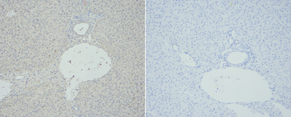 Fig.2. 左圖:SuperKine™ 增強型稀釋液IHC驗證的結(jié)果,,右圖:未加一抗的陰性對照,。樣本為小鼠肝組織,。一抗:TNF-α多克隆抗(ABP0127 ,1:200),,二抗:山羊抗兔IgG(A21020,,1:300)。