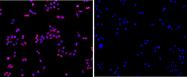 Fig.3. 左图：SuperKine™增强型稀释液IF验证的结果，右图：未加一抗的阴性对照。 样本为Hela细胞。一抗为CK7 单克隆抗体（ABM0018 ，1:200），二抗为Dylight 549, Goat Anti-Mouse IgG（ A23310 ，1:200）。