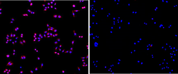 Fig.3. 左圖:SuperKine™增強型稀釋液IF驗證的結(jié)果,,右圖:未加一抗的陰性對照。樣本為Hela細胞,。一抗為CK7 單克隆抗體(ABM0018 ,1:200),,二抗為Dylight 549, Goat Anti-Mouse IgG( A23310 ,,1:200)。