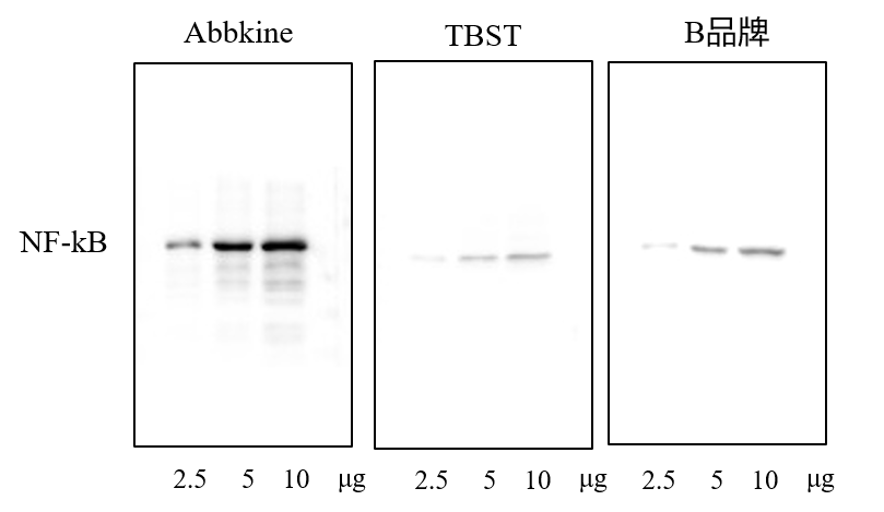 Fig.1.Superkine™ 增强型抗体稀释液（BMU103-CN）与普通抗体稀释液（TBST）以及同级竞品（B品牌）进行对比WB实验，显示Superkine™ 稀释液信噪比更高。样本: HEK293细胞； 一抗:小鼠抗NFkBp65单抗(ABM0017，1：5000)；