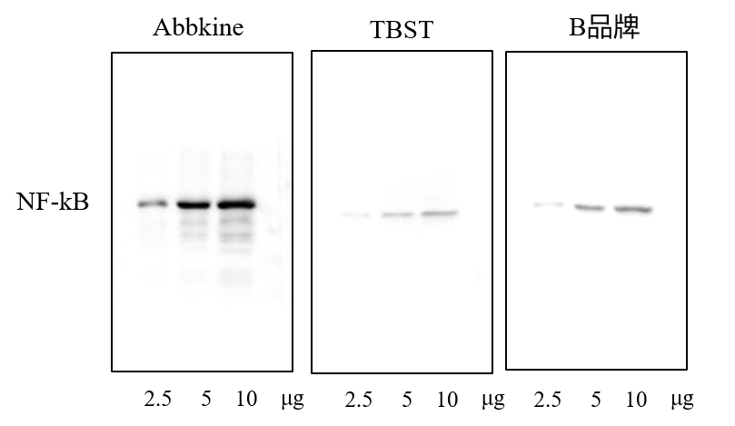 Fig.1.Superkine™ 增強型抗體稀釋液(BMU103-CN)與普通抗體稀釋液(TBST)以及同級競品(B品牌)進行對比WB實驗,,顯示Superkine™ 稀釋液信噪比更高。樣本: HEK293細胞,; 一抗:小鼠抗NFkBp65單抗(ABM0017,,1:5000),;