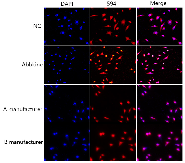 Fig.1. The second row is the rendering after using Abbkine Enhanced Antifade Mounting Medium, comprehensively comparing the product of brand A and brand B, the SuperKine™ Enhanced Antifade Mounting Medium produced by Abbkine shows more 