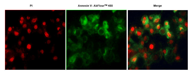 Fig.1. Hela cells were induced with camptothecin for 24 hours and stained with Annexin V- AbFluor™ 488/PI Apoptosis Detection Kit. The cell is a late stage apoptotic/necrotic cell with both Annexin V- AbFluor™ 488 and PI staining (green membrane with red fragmented nucleus).