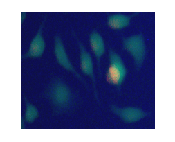 Fig.2. Hela cells incubated with staining solution in Abbkine Live and Dead Cell Double Staining Kit for 20min.
