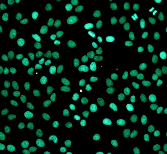 Fig. Fluorescence images using Abbkine TUNEL Apoptosis Detection Kit (Green Fluorescence) in HeLa cells with the treatment of 10 U/mL Dnase I for 10min.