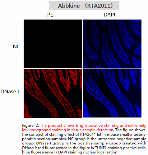 Fig. Fluorescence images using Abbkine TUNEL Apoptosis Detection Kit (Orange Fluorescence) in HeLa cells with the treatment of 10 U/mL Dnase I for 10min.