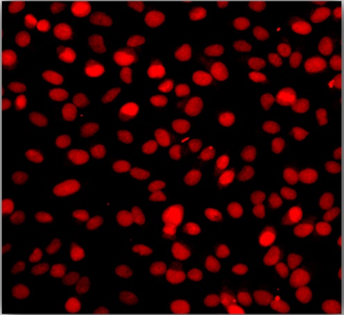 Fig. Fluorescence images using Abbkine TUNEL Apoptosis Detection Kit (Orange Fluorescence) in HeLa cells with the treatment of 10 U/mL Dnase I for 10min.