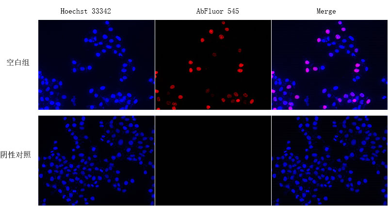 Fig. Proliferating Hela cells detected using Cell Proliferation EdU Image Kit (Orange Fluorescence).