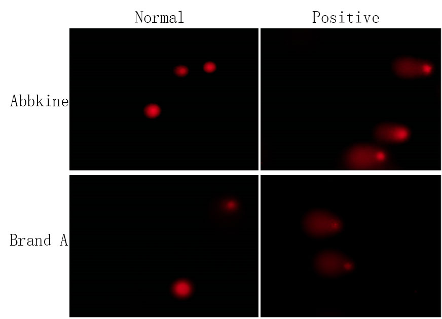Fig.The Abbkine Comet Assay Kit was used to detect DNA damage in Jurkat normal cells and DNA damage induced positive control group. And it’s compared with other brand A. The fluorescence brightness and clarity detected by Abbkine Comet Assay Kit are higher than the other brand.