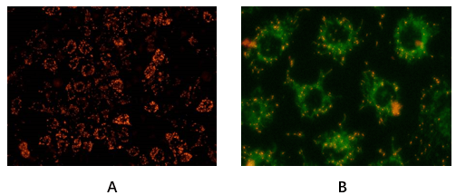 Fig. Hela cells stained with Abbkine Mitochondrial Membrane Potential Assay Kit (JC-1). 
A: Red fluorescence indicates healthy mitochondria, B: Green fluorescence indicates mitochondria in poor health (30min incubation in 20uM CCCP).