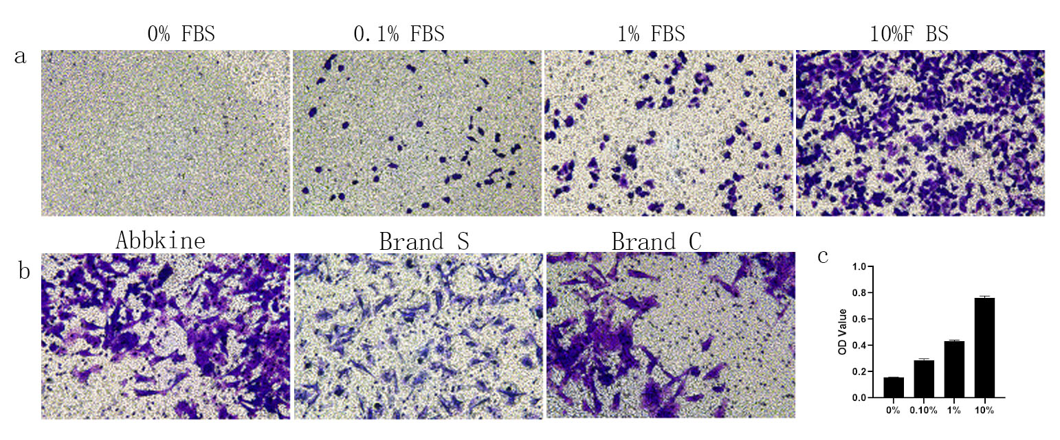 Fig1. a--After inducing SW480 cells with different concentrations of FBS, the migration of SW480 cells were detected by the Cell Invasion Assay Kit (24 well,8μM)；b--Comparison of cell migration assay results with other well-known brands.