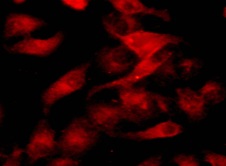 Fig.  Hela cells stained with TraKine™ Cell Plasma Membrane Staining Kit (Orange Fluorescence).