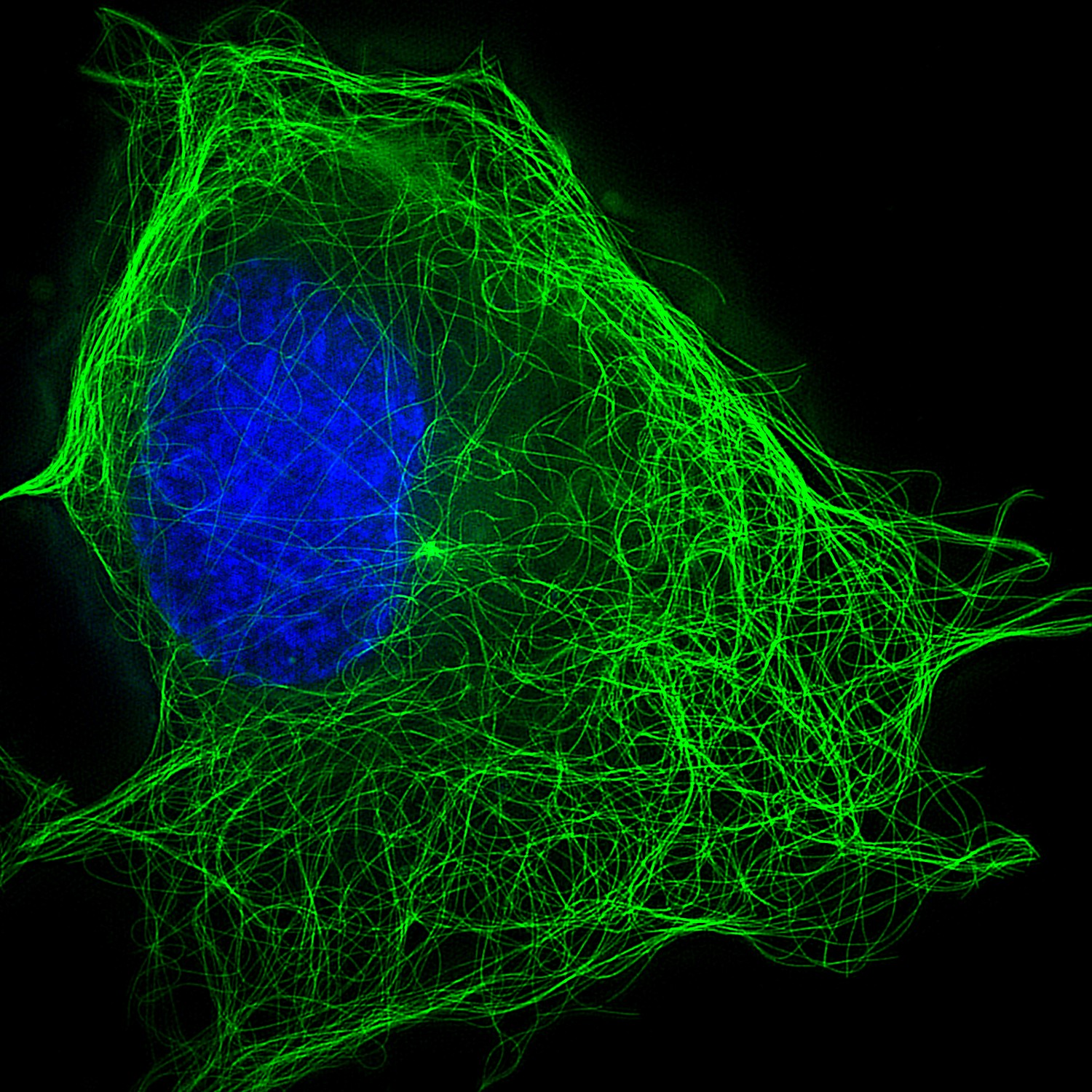 Fig.1. Markers of Tubulin -green in U-2 OS.