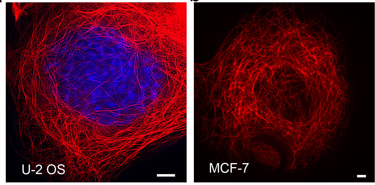 Fig.2.Confocal imaging results of other cells using TraKine™ Pro Live-cell Tubulin-traker kit (Red Fluorescence).