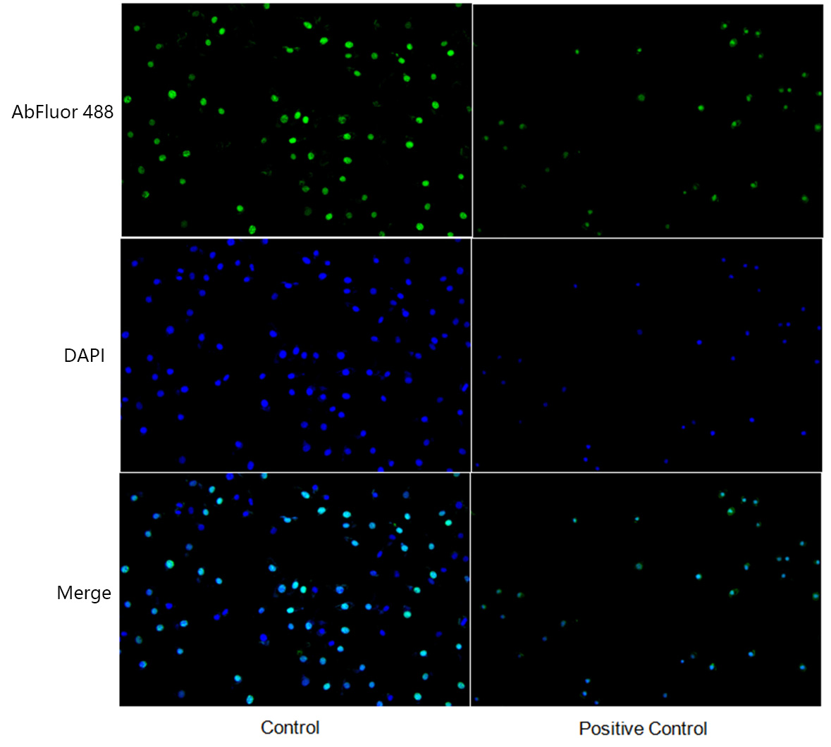 Fig.2. Cell Proliferation EdU Image Kit (Green Fluorescence) was used to detect the cytotoxicity of HEK293 cells after cytotoxicity induction.