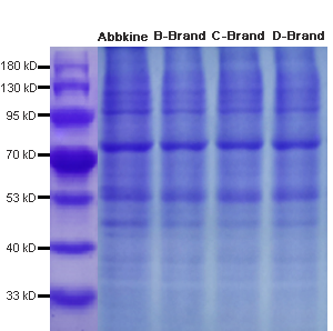 Fig 1. The SDS-PAGE image of the protein extracted from the cell sample using ExKine™ Pro Total Protein Extraction Kit for Animal Cultured Cells/Tissues(Cat. No: KTP3007) and adding SDS-PAGE Protein Sample Loading Buffer (5X) (Cat. No: KTD3003); The left lane uses Abbkine products, and the remaining lanes are products of other brands.