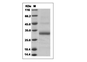 Fig.SDS-PAGE analysis of Human Noggin protein.
