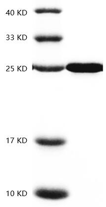 Fig.SDS-PAGE analysis of Human CNTF protein.